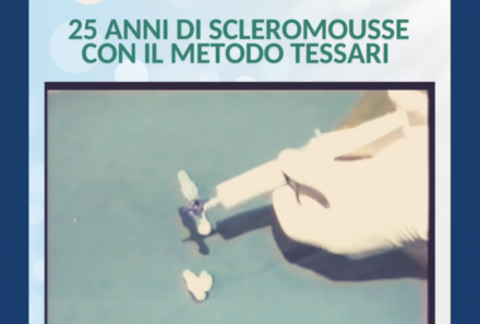 25 Anni di storia – Il Metodo Tessari per fare Scleroterapia